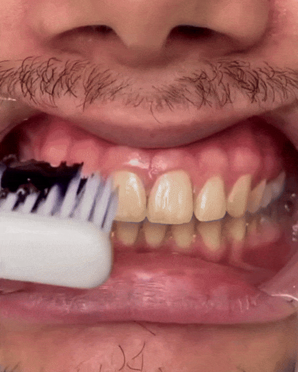 Dr. Smile V34 Colour Corrector Serum 30ml