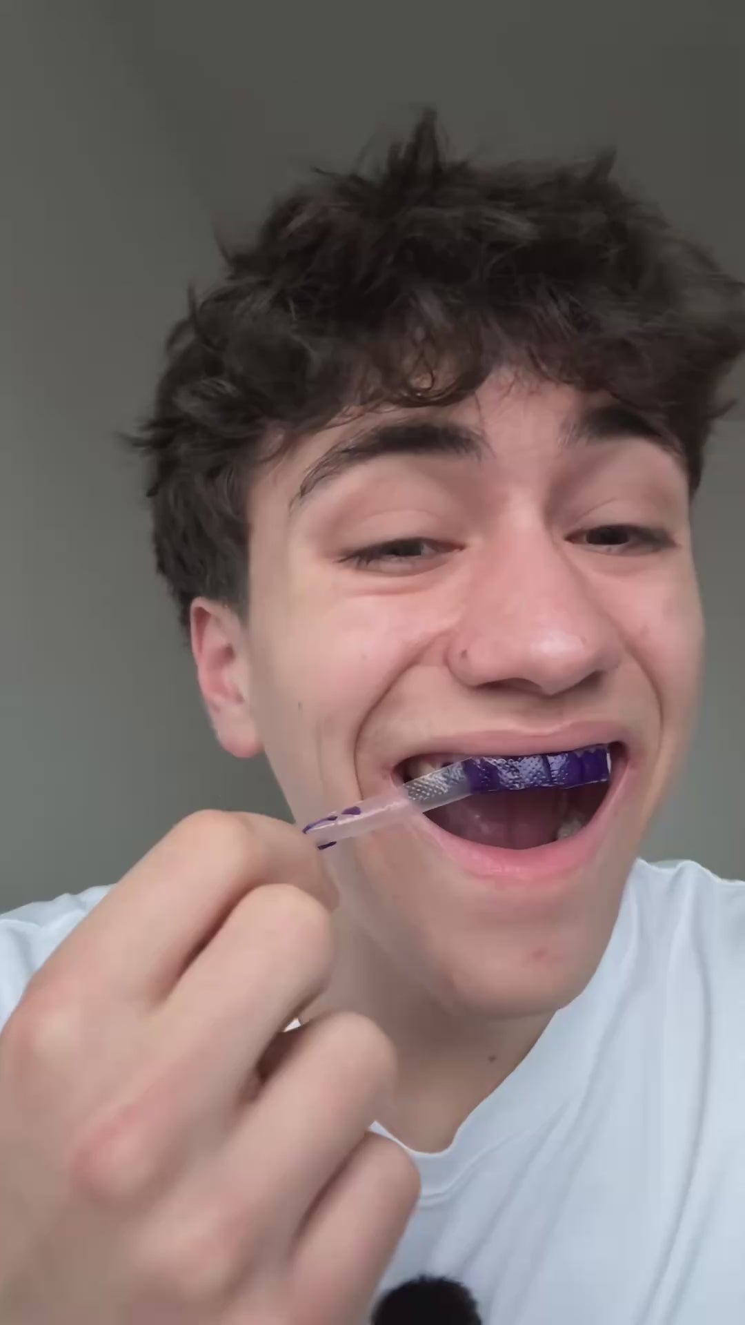 Video laden: Dr. Smile - Whitening Strips v34