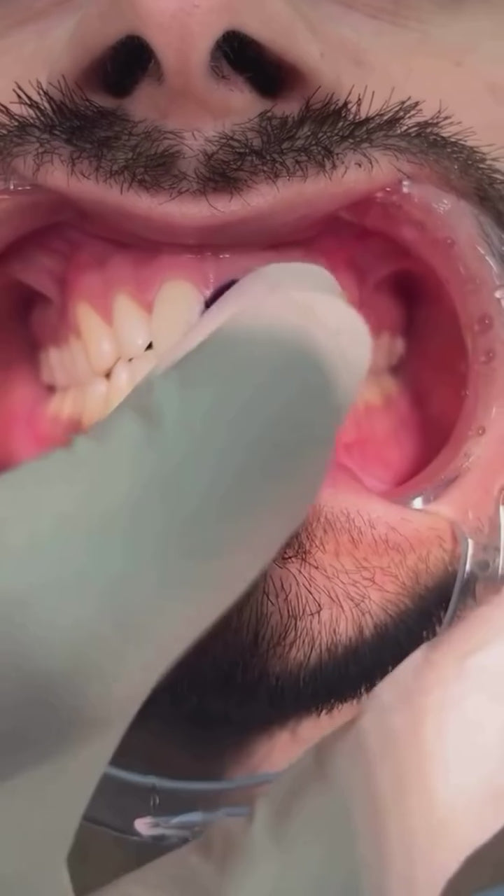 Video laden: Dr. Smile V34 Colour Corrector Serum 30ml